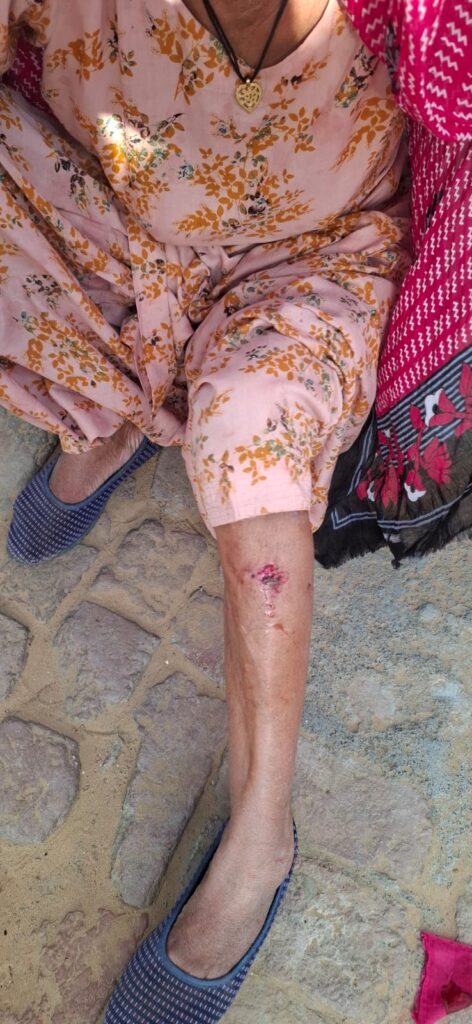 थिलोड के खेतों में बने घरों में घुसकर पागल लोमड़ी ने रात्रि 12 बजे से सुबह 4 बजे तक आंतक मचाकर 3 महिलाओं व क़रीबन एक दर्जन मवेशियों को घायल कर दिया