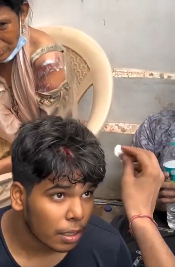 पुलिस और सेना ने इस निहत्थे छात्र को कितना मारा होगा की इसका सिर फट गया पुलिस और सेना ने इस निहत्थे छात्र को कितना मारा होगा की इसका सिर फट गया