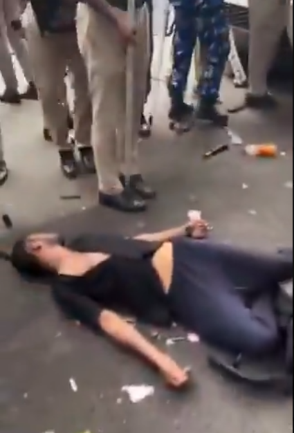 अमित शाह की दिल्ली पुलिस के अत्याचार और मार का शिकार एक युवा अमित शाह की दिल्ली पुलिस के अत्याचार और मार का शिकार एक युवा